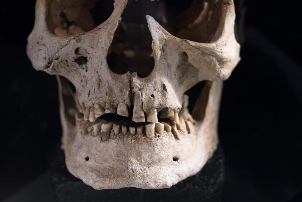 TORONTO, ONTARIO, CANADA - 2018/02/26: Viking or Norse culture objects.  Male Cranium with heavily worn out teeth. The study of archeological findings reveals that current conceptions often differ from what Vikings really were. (Photo by Roberto Machado Noa/LightRocket via Getty Images)